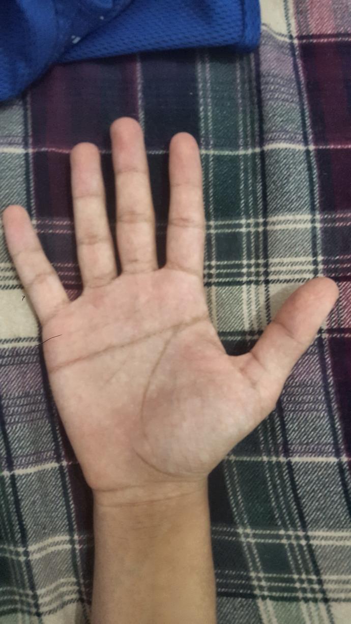 Sizin de aranızda avuç içi şekilleri bunun gibi farklı olan var mı?