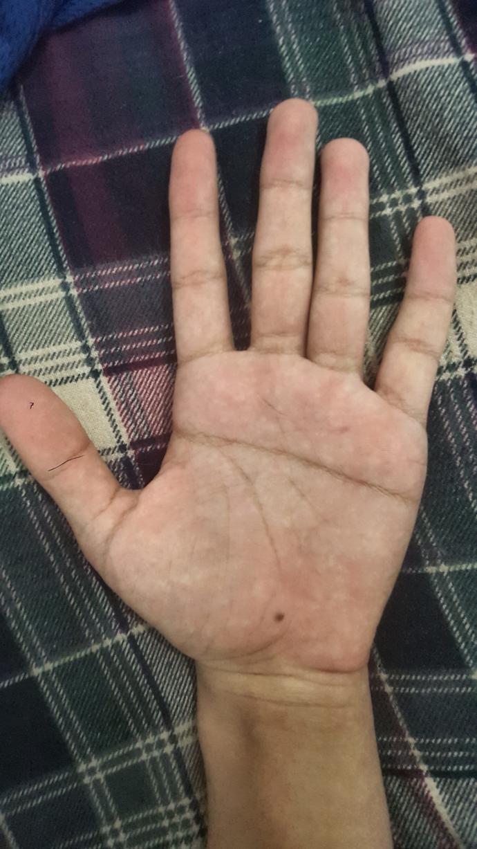 Sizin de aranızda avuç içi şekilleri bunun gibi farklı olan var mı?