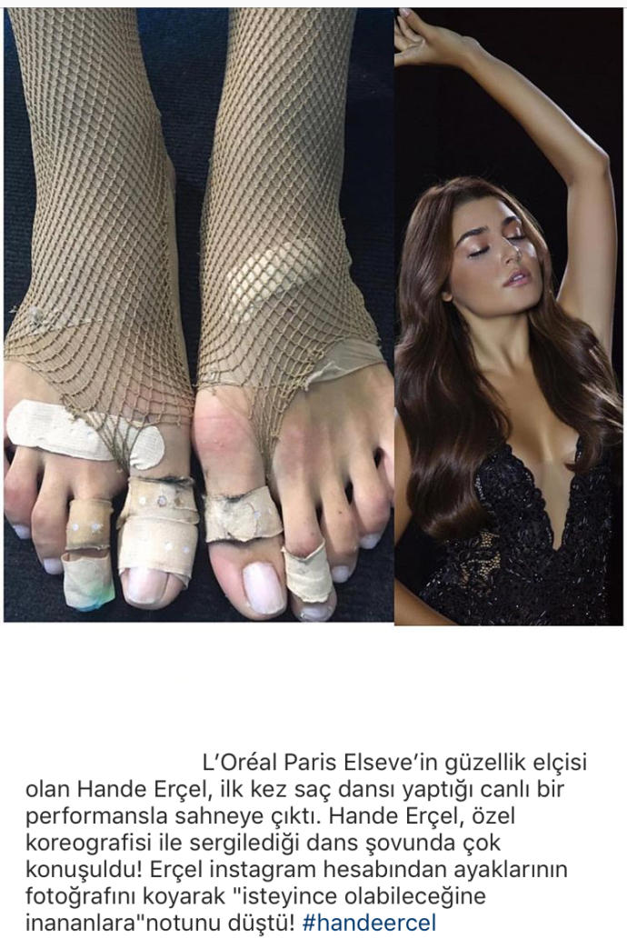Hande Erçel Dans şovundan sonra ayaklarının resmini paylaştı, dansını ve ayaklarını nasıl buldunuz?