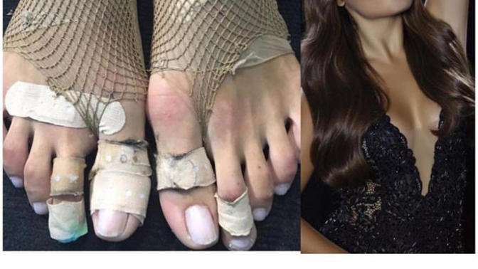 Hande Erçel Dans şovundan sonra ayaklarının resmini paylaştı, dansını ve ayaklarını nasıl buldunuz?