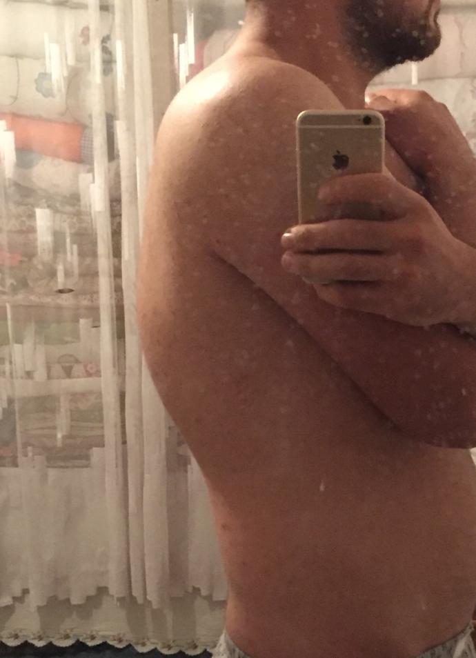 Belimdeki kamburluk mu yoksa başka birşey mi sizce ?