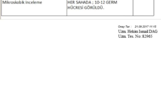 Sperm testi sonucumu yorumlar mısınız, ne anlatıyor burada?