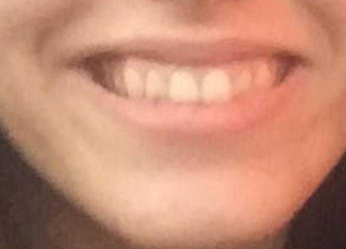 Felc Miyim Kizlarsoruyor Felc Miyim Kizlarsoruyor