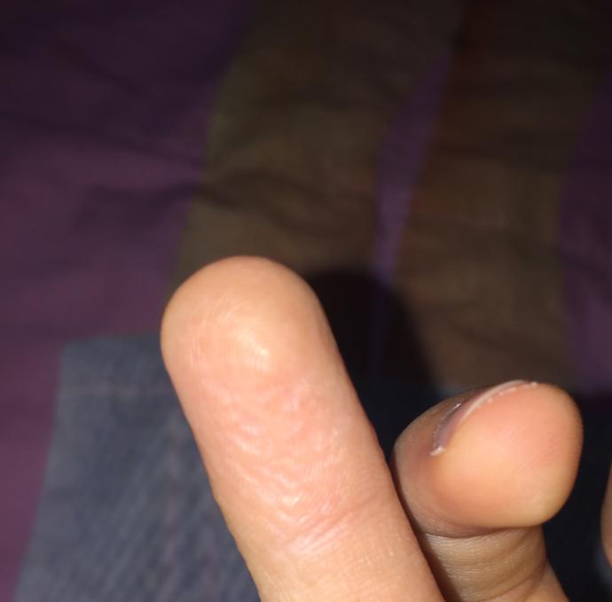 Elimdeki şey nedir?