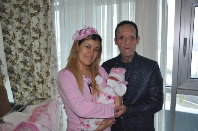 Sevgiliniz yüz felci olsa, onunla görüşmeye devam eder misiniz, yoksa uzaklaşır ve hayatınızdan mı silersiniz?