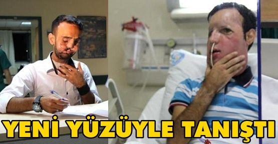 Sevgiliniz yüz felci olsa, onunla görüşmeye devam eder misiniz, yoksa uzaklaşır ve hayatınızdan mı silersiniz?