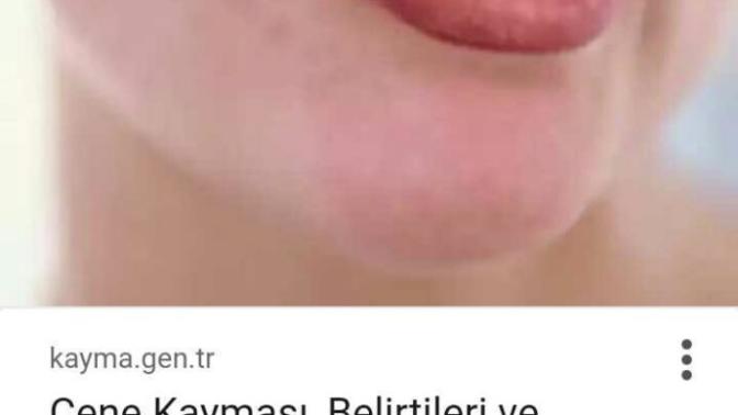 Ağzım konusurken yamuluyor🙁 neden?
