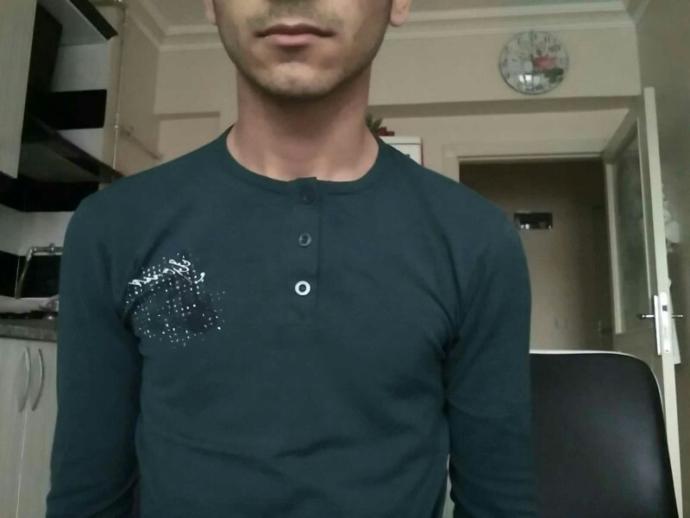 Bir omuzum diğerine göre kısa ve daha aşağıda ??