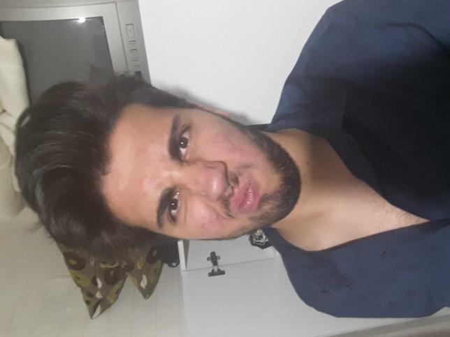 Ön kamera arka kamera farkı.Neden bu kadar farklı??