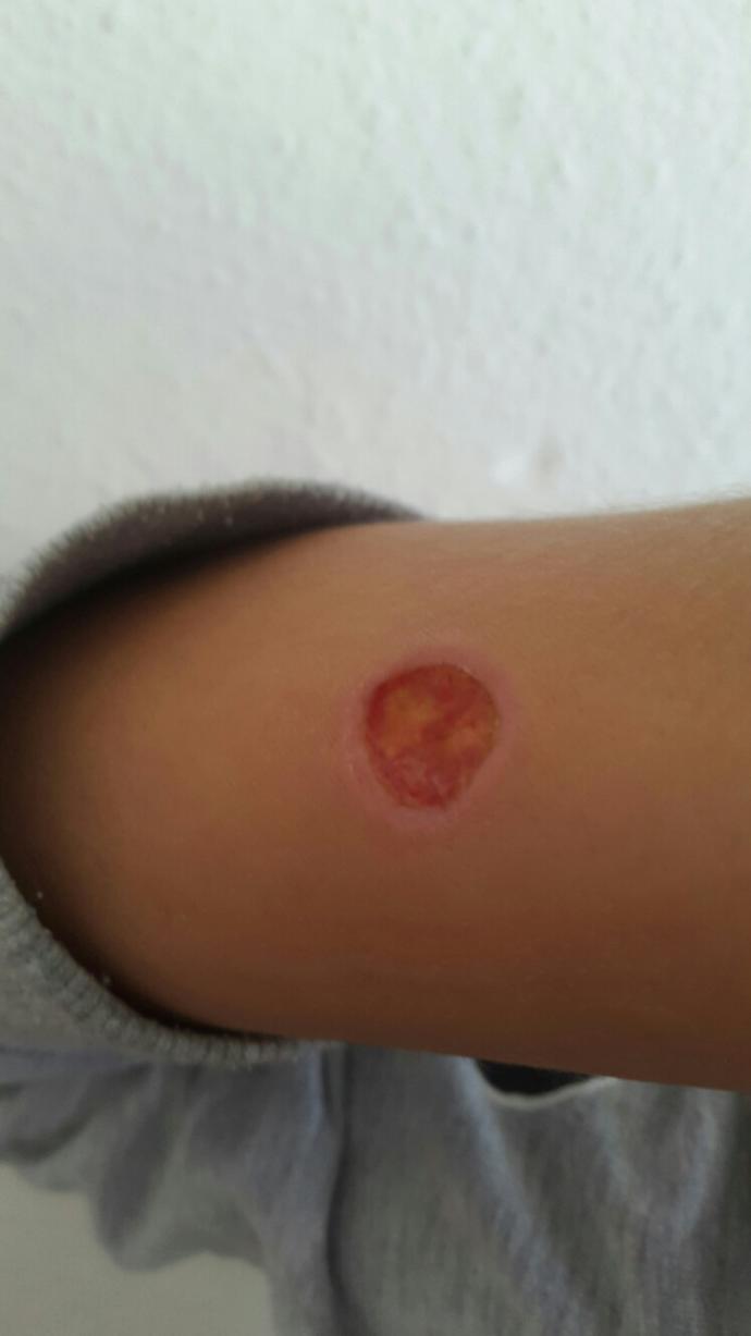 Kolumdaki yara bir türlü geçmiyor! :(?
