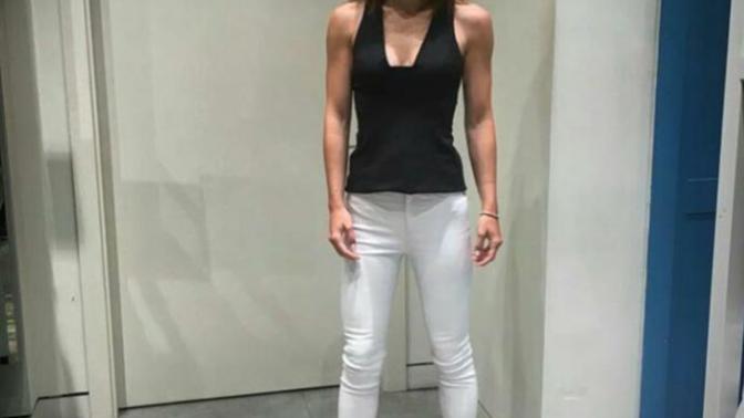 Merve Boluğur'un yeni hali sizce de acayip değil mi çok çirkinleşmiş eski haline göre?