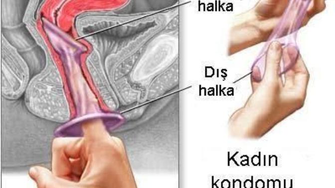 Kadın prezervatifi kullanan oldu mu? Yararlarını biliyor musunuz?