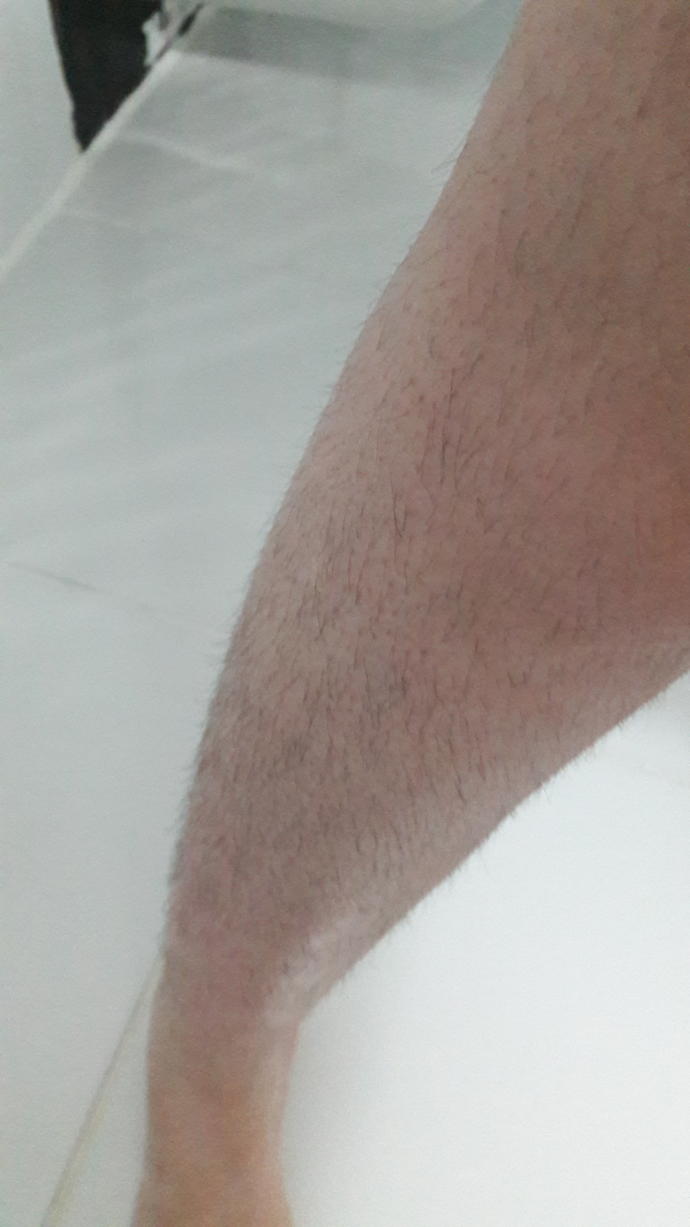 Sizce bu bacak bir kiz icin normal mi?