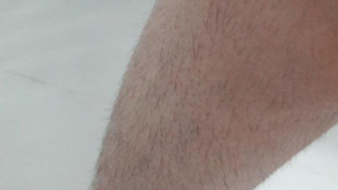 Sizce bu bacak bir kız için normal mi?