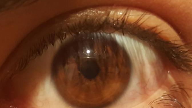 Bu göze yeşil lens takmak istiyorum, Nerede satılır nasıl kullanılır?