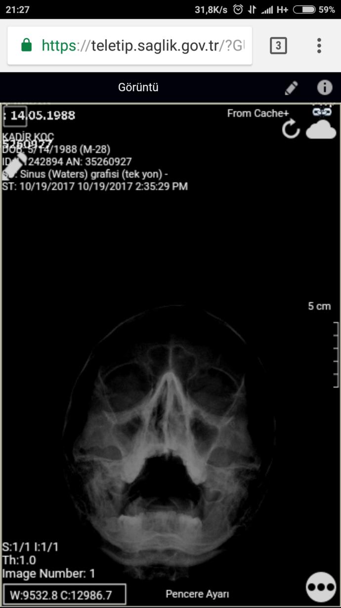 Doktor var mı bir röntgen var bakabilirmisiniz?