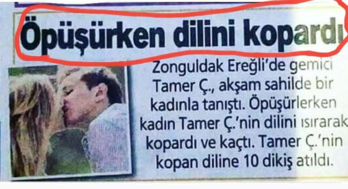 Öpüşürken sevgiliniz, dilinizi ısırsa ne tepki verirsiniz?