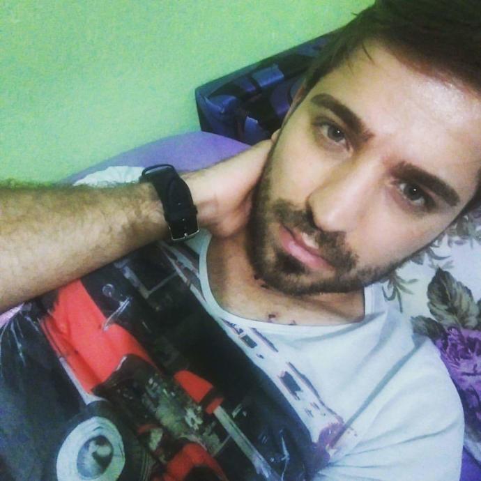 Ameliyat oykum. Troid boyun diseksiyonu ameliyatin ve arda kalanlar. 1 senem olay oldu iyi sizinle paylasmak istedim. Nasil sizce?