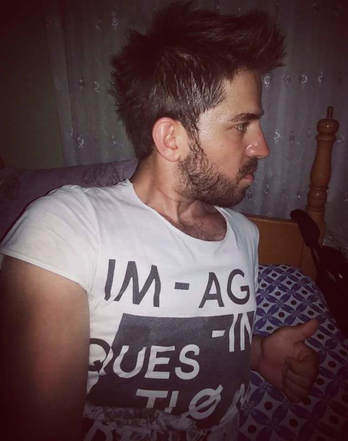 Ameliyat oykum. Troid boyun diseksiyonu ameliyatin ve arda kalanlar. 1 senem olay oldu iyi sizinle paylasmak istedim. Nasil sizce?