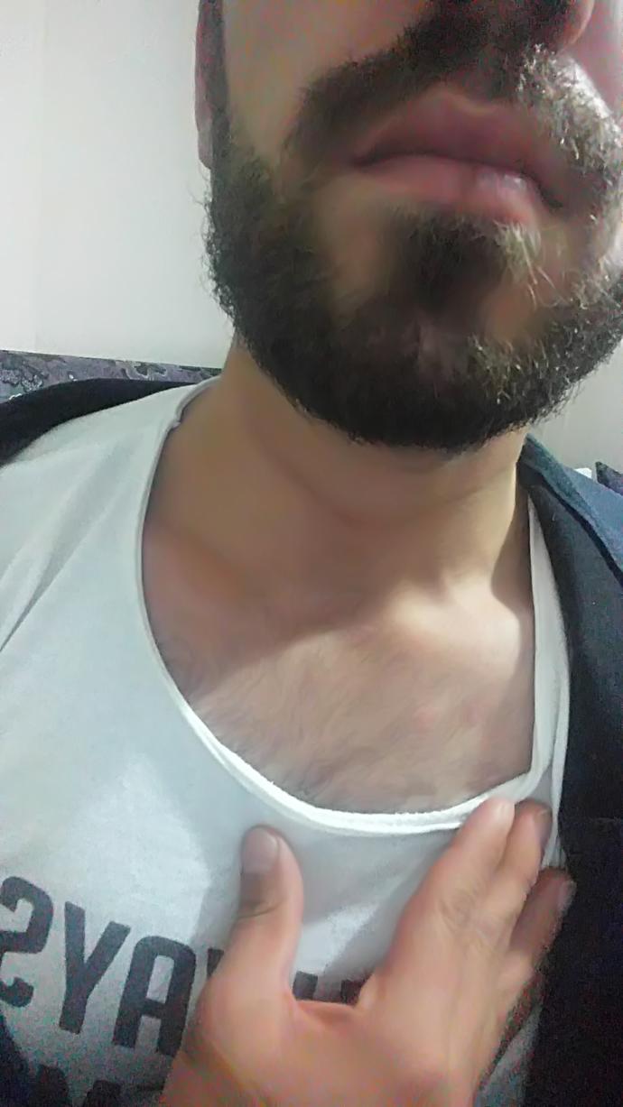 Ameliyat oykum. Troid boyun diseksiyonu ameliyatin ve arda kalanlar. 1 senem olay oldu iyi sizinle paylasmak istedim. Nasil sizce?