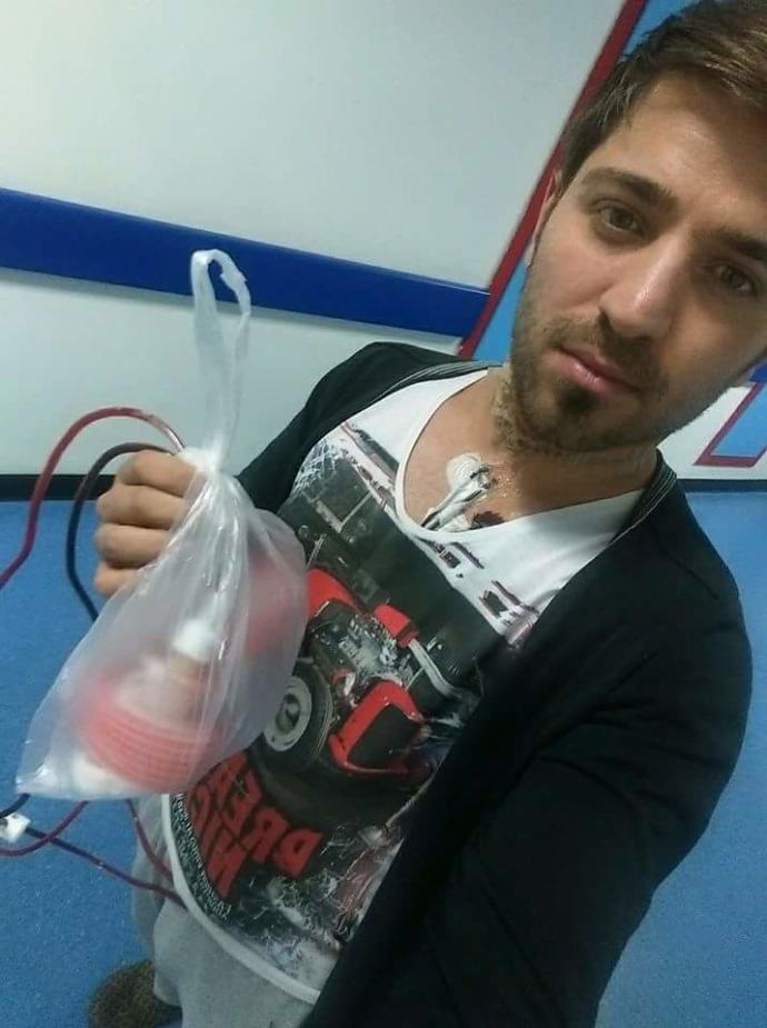 Ameliyat oykum. Troid boyun diseksiyonu ameliyatin ve arda kalanlar. 1 senem olay oldu iyi sizinle paylasmak istedim. Nasil sizce?