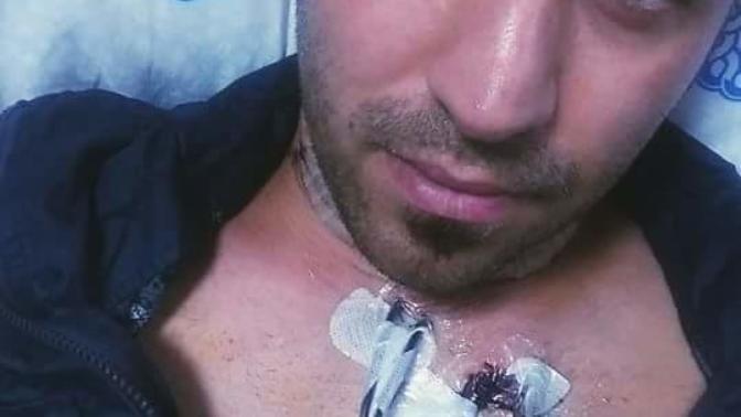 Ameliyat oykum. Troid boyun diseksiyonu ameliyatin ve arda kalanlar. 1 senem olay oldu iyi sizinle paylasmak istedim. Nasil sizce?