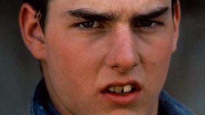 Tom Cruise 1Trilyona mâl olan estetik ameliyati ile cok degismemismi?