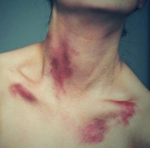 Kızlar, Sevgilinize, hickey yapmak ister miydiniz, size ait olduğunu gösteren bir simge?
