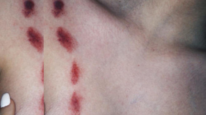 Kızlar, Sevgilinize, hickey yapmak ister miydiniz, size ait olduğunu gösteren bir simge?