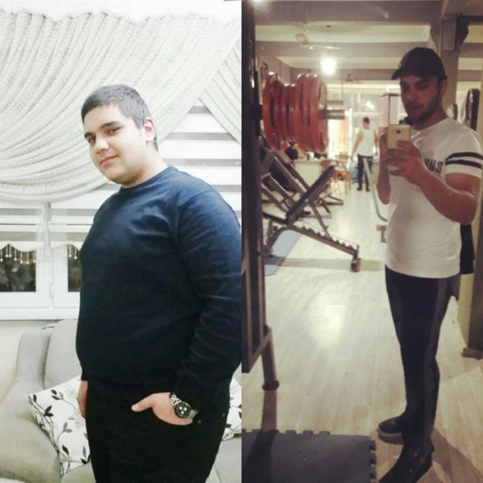 7 Ayda 55 Kilo Verdim Sonuç Bu Nasıl??