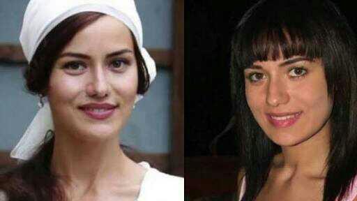 Şoke oldum Fahriye Evcen estetik??