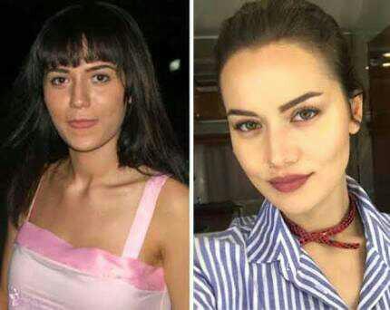 Şoke oldum Fahriye Evcen estetik??