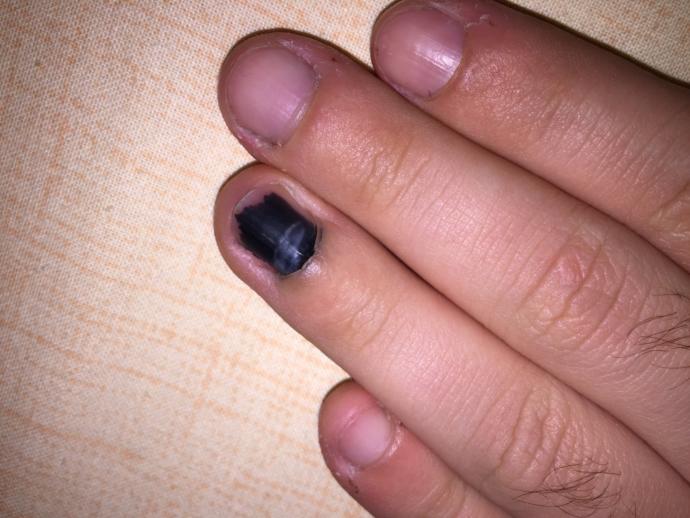 Bu tırnak atacak mı kendini?