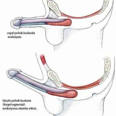 Erkekler, Eğri penis nedir nasıl oluyor?