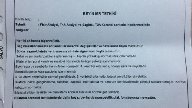 Bu Mr. sonucu Nedir?