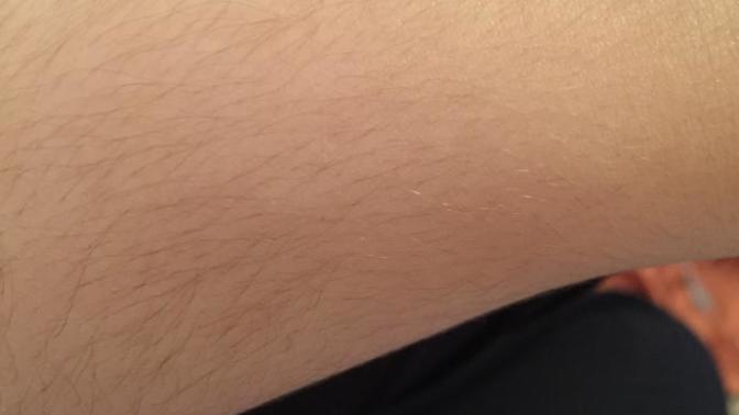Kolumdaki kılları almalı mıyım? Ağdayla alırsam daha çok çıkar mı?