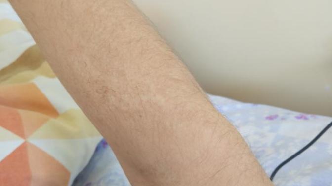 YANIK İZİ PMYO ENGEL Mİ? FOTOĞRAFLI)?