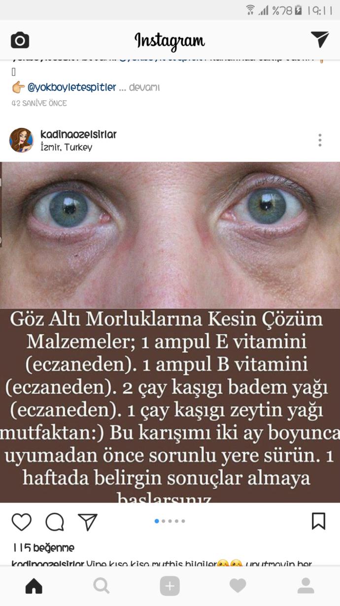 Göz altlarım çok yorgun görünüyor. Nasıl düzeltebilirim?