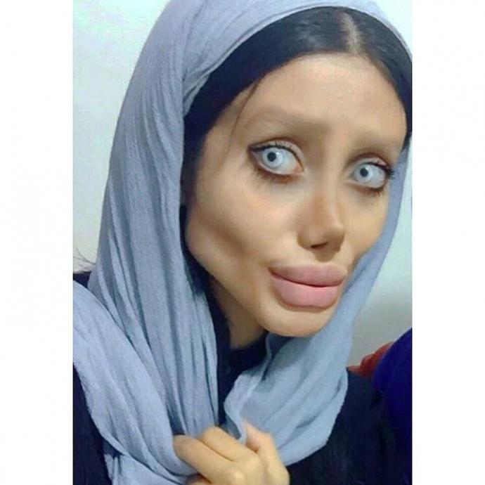 Angelina Jolie'ye benzemek isteyen İranlı kadın bunu başarmış mı sizce?