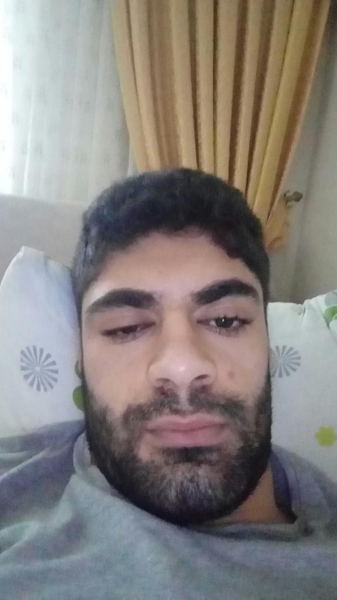 Yüzüm nasıl düzelicek yeter lan?