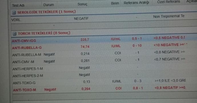 Anlayan var mi sonuc nedir sizce ?