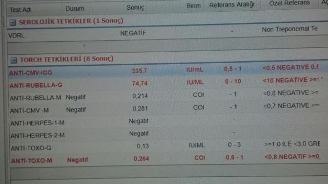 Anlayan var mi sonuc nedir sizce?