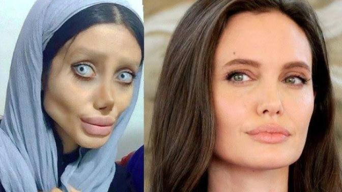 Angelina Jolie'ye benzemek için servet harcayan İranlı genç kız herkesi şaşırttı! Güzel olmak için birine benzemek ister misiniz?