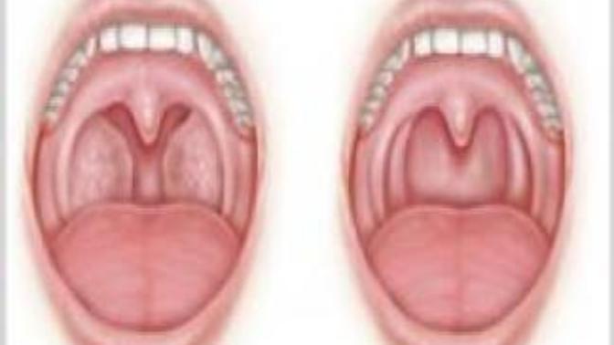 Yutkunamıyorum 😔Bademciklerim şişmiş dün gece yatarken. Neden durup dururken şişer ki?