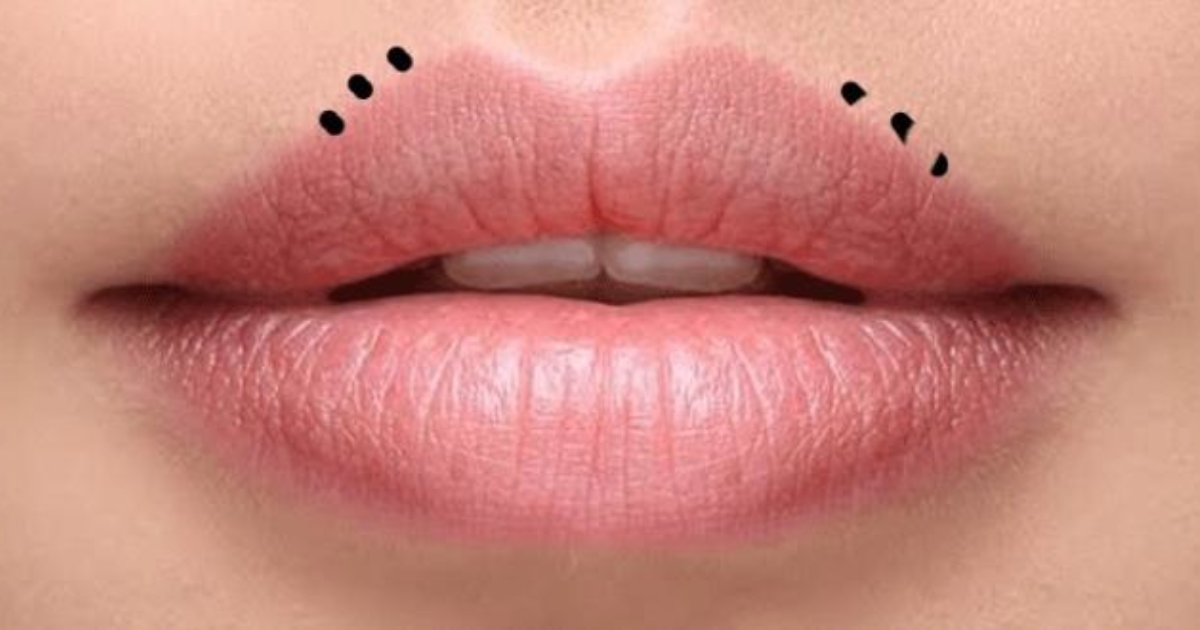 Dudağınızda siyah nokta çıkıyor mu ? - KizlarSoruyor