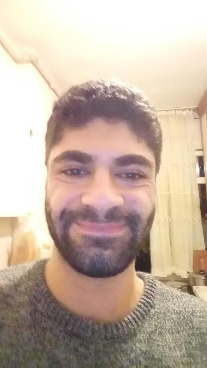 Yüzüm deki kırışıklar nasıl düzelir?