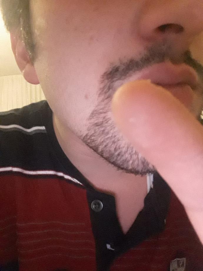 Bıyıklarım batıyor nasıl geçer bu kesmeden ?