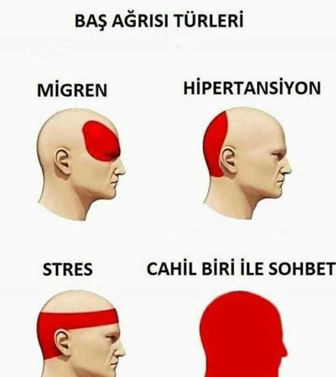 Başınızın en çok neresi ağrır (resimli) :D :D ?