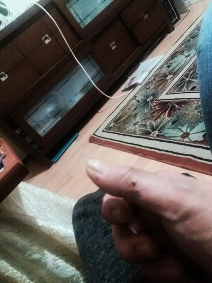 Tırnağımı yememek için ne yapmalıyım?