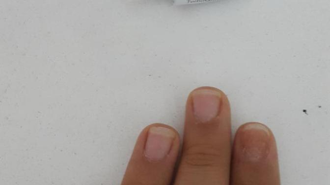 Tırnak mantarı için önerisi olan?